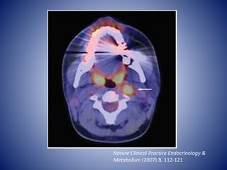 HEAD AND NECK cross sectional pet ct anatomy | PPTX