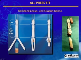 ALL PRESS FIT Semitendinosus- und Grazilis-Sehne 