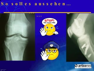 So soll es aussehen…      so nicht!!! ... 