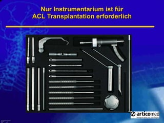 Nur Instrumentarium ist für ACL Transplantation erforderlich 