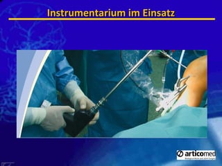 Instrumentarium im Einsatz 