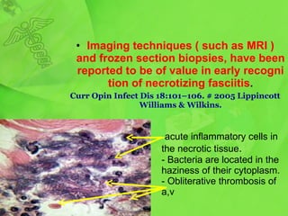 acute inflammatory cells in the necrotic tissue . - Bacteria are located in the haziness of their cytoplasm. - Obliterative thrombosis of a,v Imaging   techniques  (  such as  MRI )  and   frozen section biopsies, have been reported to be of value in   early recognition of necrotizing fasciitis . Curr Opin Infect Dis 18:101–106. # 2005 Lippincott Williams & Wilkins. 
