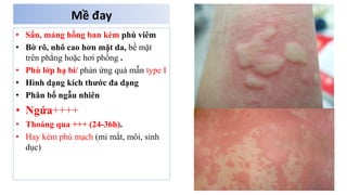 Comprehensive Overview of Febrile Rash and Erythema Types in Clinical ...
