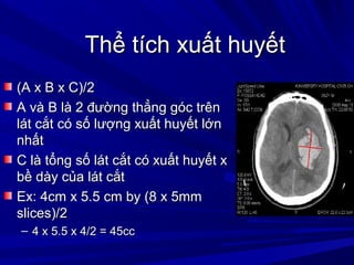 Thể tích xuất huyếtThể tích xuất huyết
(A x B x C)/2(A x B x C)/2
A và B là 2 đường thẳng góc trênA và B là 2 đường thẳng góc trên
lát cắt có số lượng xuất huyết lớnlát cắt có số lượng xuất huyết lớn
nhấtnhất
C là tổng số lát cắt có xuất huyết xC là tổng số lát cắt có xuất huyết x
bề dày của lát cắtbề dày của lát cắt
Ex: 4cm x 5.5 cm by (8 x 5mmEx: 4cm x 5.5 cm by (8 x 5mm
slices)/2slices)/2
– 4 x 5.5 x 4/2 = 45cc4 x 5.5 x 4/2 = 45cc
 