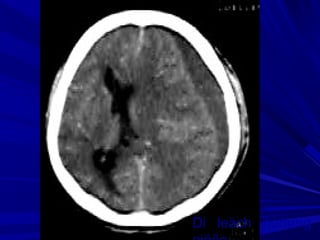 Di leäch ñöôøng
 