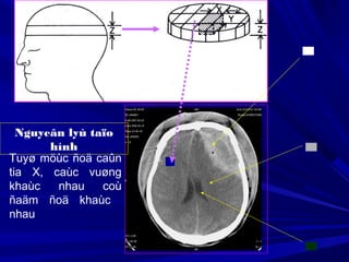 Nguyeân lyù taïo
hình
Tuyø möùc ñoä caûn
tia X, caùc vuøng
khaùc nhau coù
ñaäm ñoä khaùc
nhau
 