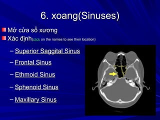 6. xoang(Sinuses)6. xoang(Sinuses)
Mở cửa sổ xươngMở cửa sổ xương
Xác địnhXác định((clickclick on the names to see their location)on the names to see their location)
– Ethmoid SinusEthmoid Sinus
– Sphenoid SinusSphenoid Sinus
– Superior Saggital SinusSuperior Saggital Sinus
– Frontal SinusFrontal Sinus
– Maxillary SinusMaxillary Sinus
 