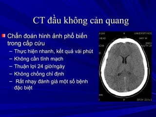 CT đầu không cản quangCT đầu không cản quang
Chẩn đoán hình ảnh phổ biếnChẩn đoán hình ảnh phổ biến
trong cấp cứutrong cấp cứu
– Thực hiện nhanh, kết quả vài phútThực hiện nhanh, kết quả vài phút
– Không cần tĩnh mạchKhông cần tĩnh mạch
– Thuận lợi 24 giờ/ngàyThuận lợi 24 giờ/ngày
– Không chống chỉ địnhKhông chống chỉ định
– Rất nhạy đánh giá một số bệnhRất nhạy đánh giá một số bệnh
đặc biệtđặc biệt
 