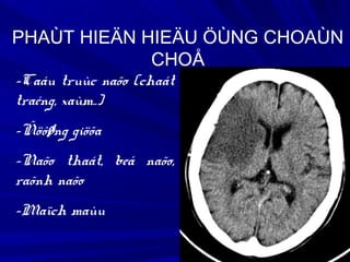 -Caáu truùc naõo (chaát
traéng, xaùm..)
-Ñöôøng giöõa
-Naõo thaát, beå naõo,
raõnh naõo
-Maïch maùu
PHAÙT HIEÄN HIEÄU ÖÙNG CHOAÙN
CHOÅ
 