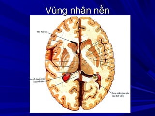 Vùng nhân nềnVùng nhân nền
 