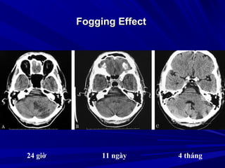 Fogging EffectFogging Effect
24 giờ 11 ngày 4 tháng
 