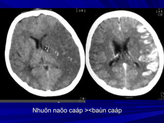 Nhuõn naõo caáp ><baùn caáp
 