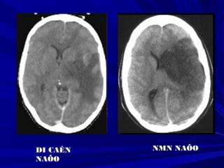 DI CAÊNDI CAÊN
NAÕONAÕO
NMN NAÕONMN NAÕO
 