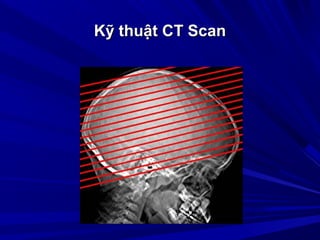 Kỹ thuật CT ScanKỹ thuật CT Scan
 