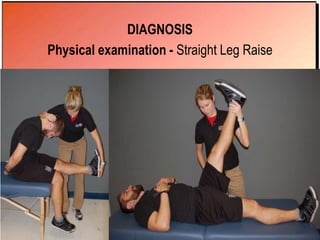 DIAGNOSIS
Physical examination - Straight Leg Raise
 