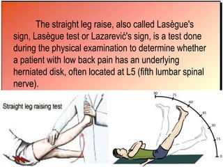 The straight leg raise, also called Lasègue's
sign, Lasègue test or Lazarević's sign, is a test done
during the physical examination to determine whether
a patient with low back pain has an underlying
herniated disk, often located at L5 (fifth lumbar spinal
nerve).
 