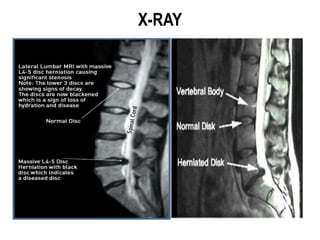 X-RAY
 