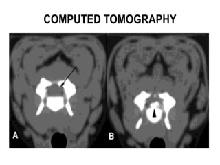 COMPUTED TOMOGRAPHY
 