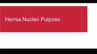 Hernia Nucleo Pulposo
 