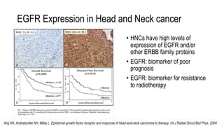 Radiotherapy and Cetuximab in head and neck cancer.pptx