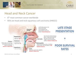 Head and Neck Cancer
• 6th most common cancer worldwide
• 95% are head and neck squamous cell carcinoma (HNSCC)




©2012 Caris Life Sciences, Ltd. and Affiliates            3
 