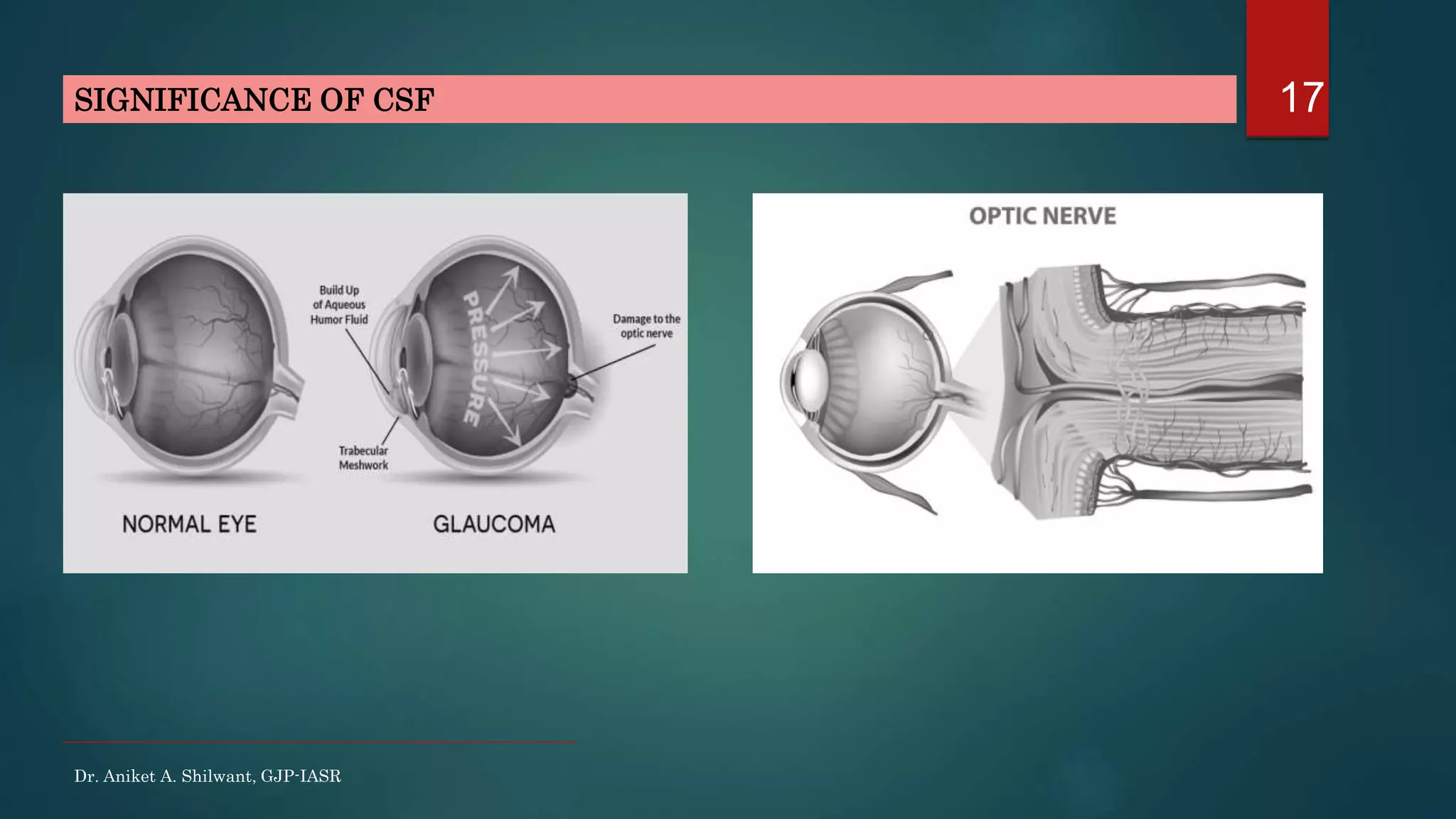 17
Dr. Aniket A. Shilwant, GJP-IASR
SIGNIFICANCE OF CSF
 