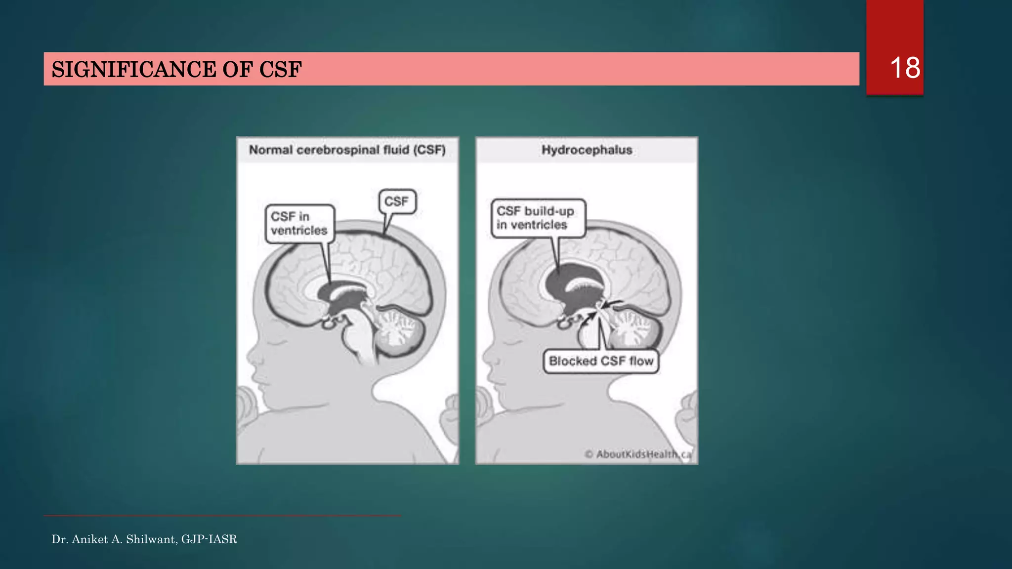 18
Dr. Aniket A. Shilwant, GJP-IASR
SIGNIFICANCE OF CSF
 