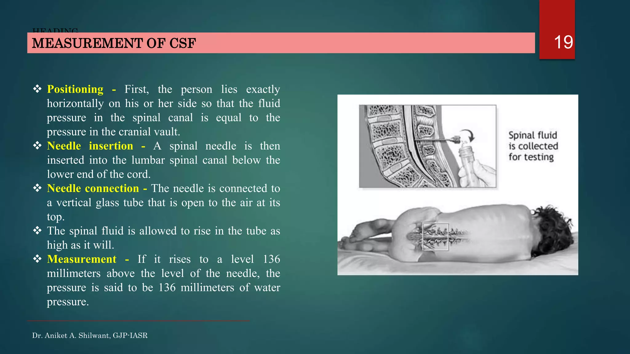 19
HEADING
 Positioning - First, the person lies exactly
horizontally on his or her side so that the fluid
pressure in the spinal canal is equal to the
pressure in the cranial vault.
 Needle insertion - A spinal needle is then
inserted into the lumbar spinal canal below the
lower end of the cord.
 Needle connection - The needle is connected to
a vertical glass tube that is open to the air at its
top.
 The spinal fluid is allowed to rise in the tube as
high as it will.
 Measurement - If it rises to a level 136
millimeters above the level of the needle, the
pressure is said to be 136 millimeters of water
pressure.
MEASUREMENT OF CSF
Dr. Aniket A. Shilwant, GJP-IASR
 