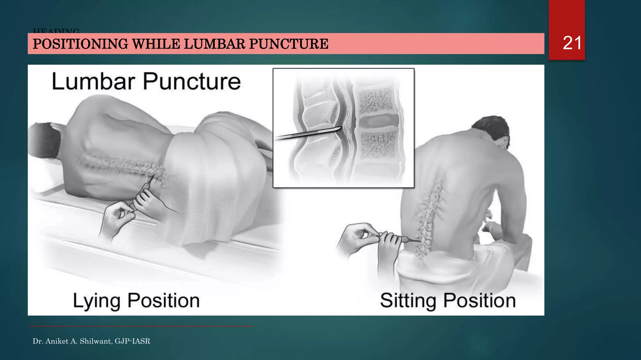 21
HEADING
POSITIONING WHILE LUMBAR PUNCTURE
Dr. Aniket A. Shilwant, GJP-IASR
 