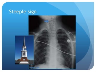 Steeple sign
 