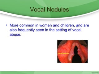 Vocal Nodules
• More common in women and children, and are
also frequently seen in the setting of vocal
abuse.
 