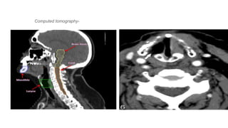 Computed tomography-
 