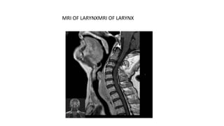 MRI OF LARYNX
MRI OF LARYNXMRI OF LARYNX
 
