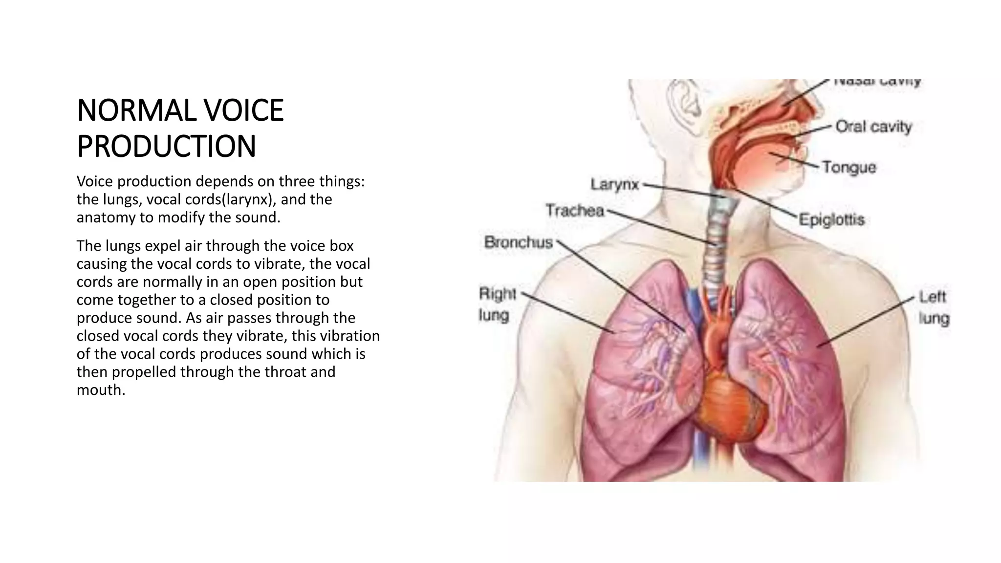 HOARSENESS OF VOICE [Recovered].pptx