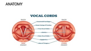 HOARSENESS OF VOICE [Recovered].pptx