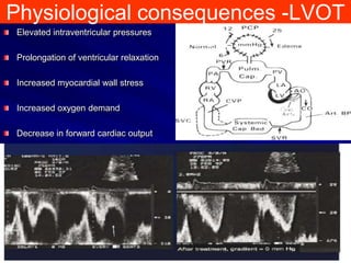 Physiological consequences -LVOT
Elevated intraventricular pressures
Prolongation of ventricular relaxation
Increased myocardial wall stress
Increased oxygen demand
Decrease in forward cardiac output

 