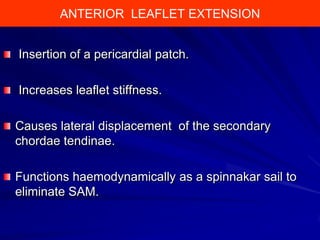 ANTERIOR LEAFLET EXTENSION
Insertion of a pericardial patch.

Increases leaflet stiffness.
Causes lateral displacement of the secondary
chordae tendinae.
Functions haemodynamically as a spinnakar sail to
eliminate SAM.

 