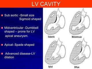 LV CAVITY
Sub aortic -Small size
Sigmoid shaped
Midventricular -Dumbbell
shaped – prone for LV
apical aneurysm.
Apical- Spade shaped
Advanced disease-LV
dilation

 