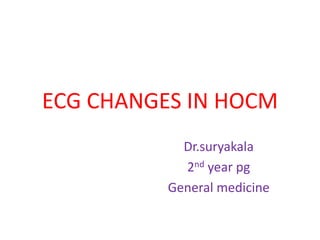 ECG CHANGES IN HOCM
Dr.suryakala
2nd year pg
General medicine
 