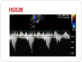 hocm.pptx