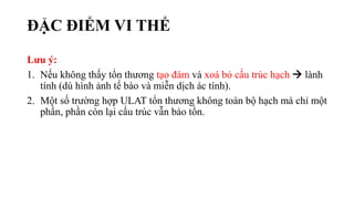 ĐẶC ĐIỂM VI THỂ
Lưu ý:
1. Nếu không thấy tổn thương tạo đám và xoá bỏ cấu trúc hạch  lành
tính (dù hình ảnh tế bào và miễn dịch ác tính).
2. Một số trường hợp ULAT tổn thương không toàn bộ hạch mà chỉ một
phần, phần còn lại cấu trúc vẫn bảo tồn.
 
