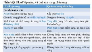 Phân biệt ULAT típ nang và quá sản nang phản ứng
ULAT típ nang Quá sản nang phản ứng
Đặc điểm cấu trúc
Xoá bỏ toàn bộ cấu trúc hạch Cấu trúc bảo tồn
Cấu trúc nang phân bố từ vỏ đến tuỷ hạch Nang ưu thế vùng vỏ hạch
Kích thước và hình dạng các nang ít thay
đổi (đồng nhất)
Thay đổi (nang kéo dài, dạng tam giác,
hình chuông)
Không rõ tâm mầm Phân biệt rõ tâm mầm sáng, áo nang sẫm
màu
Xâm nhập thành đám tế bào lympho vào
vỏ hạch và tổ chức mỡ quanh hạch, kèm
theo hoặc không cấu trúc dạng nang tế
bào u ngoài vỏ.
Không hoặc mức độ vừa phải, thường
kèm theo sự xuất hiện các loại tế bào
viêm tập trung thành đám nhỏ quanh
mạch.
Tập trung sợi võng ngoại vi quanh nang Không hoặc rất ít thay đổi mạng lưới sợi
võng
 
