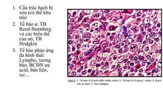 1. Cấu trúc hạch bị
xóa (có thể khu
trú)
2. Tế bào u: TB
Reed-Sternberg
và các biến thể
của nó, TB
Hodgkin
3. Tế bào phản ứng
đa hình thái:
Lympho, tương
bào, BCĐN ưa
acid, bán liên,
xơ…
 