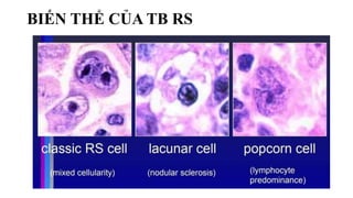 BIẾN THỂ CỦA TB RS
 