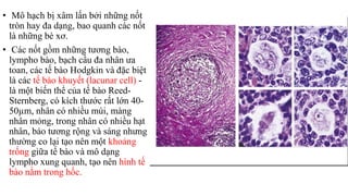 • Mô hạch bị xâm lấn bởi những nốt
tròn hay đa dạng, bao quanh các nốt
là những bè xơ.
• Các nốt gồm những tương bào,
lympho bào, bạch cầu đa nhân ưa
toan, các tế bào Hodgkin và đặc biệt
là các tế bào khuyết (lacunar cell) -
là một biến thể của tế bào Reed-
Sternberg, có kích thước rất lớn 40-
50µm, nhân có nhiều múi, màng
nhân mỏng, trong nhân có nhiều hạt
nhân, bào tương rộng và sáng nhưng
thường co lại tạo nên một khoảng
trống giữa tế bào và mô dạng
lympho xung quanh, tạo nên hình tế
bào nằm trong hốc.
 