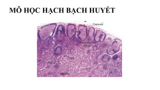 MÔ HỌC HẠCH BẠCH HUYẾT
 