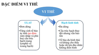 ĐẶC ĐIỂM VI THỂ
•Đơn dòng
•Tăng sinh tế bào
ác tính tạo đám
xâm nhập và phá
huỷ cấu trúc
hạch (nang
lymphô và
xoang hạch)
ULAT
•Đa dòng
•Cấu trúc hạch thay
đôi nhưng vẫn bảo
tồn
•Tế bào đa hình thái
và không cho thấy
hoặc rất kín đáo nhân
không điển hình
Hạch lành tính
VI THỂ
 