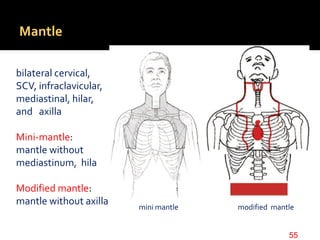 Mantle
bilateral cervical,
SCV, infraclavicular,
mediastinal, hilar,
and axilla
Mini-mantle:
mantle without
mediastinum, hila
Modified mantle:
mantle without axilla
55
mini mantle modified mantle
 