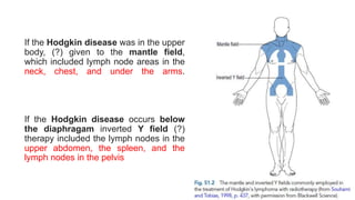 If the Hodgkin disease was in the upper
body, (?) given to the mantle field,
which included lymph node areas in the
neck, chest, and under the arms.
If the Hodgkin disease occurs below
the diaphragam inverted Y field (?)
therapy included the lymph nodes in the
upper abdomen, the spleen, and the
lymph nodes in the pelvis
 