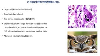 HODGKIN’S LYMPHOMA.pptx